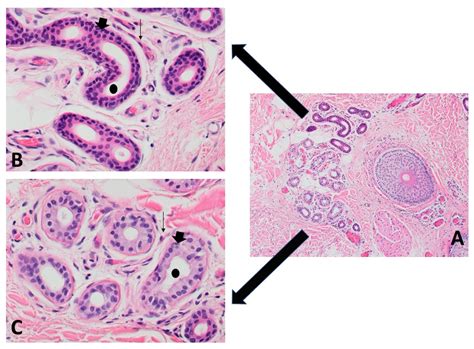 Apocrine Vs Eccrine Sweat Gland