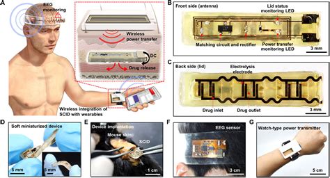 Soft implantable drug delivery device integrated wirelessly with wearable devices to treat fatal ...