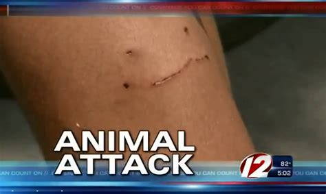 Four legged friends (and enemies): Rehoboth boy attacked by likely fisher cat