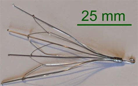 IVC Filter Retrieval - Radiology Imaging