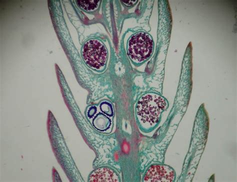 Tracheophytes (vascular seedless) microscope pictures and parts ...