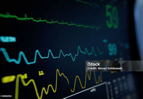 Mesin Ekg Digital Dan Grafik Di Rumah Sakit Sains Dan Elektronik Peralatan Dan Teknologi Medis ...