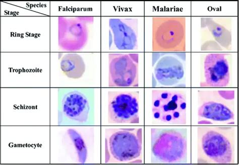 Giemsa Stain - Preparation, Procedure, Principle, Composition and ...