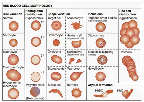 Medical Laboratory and Biomedical Science: Red Blood Cell Morphology Abnormalities | Medical ...