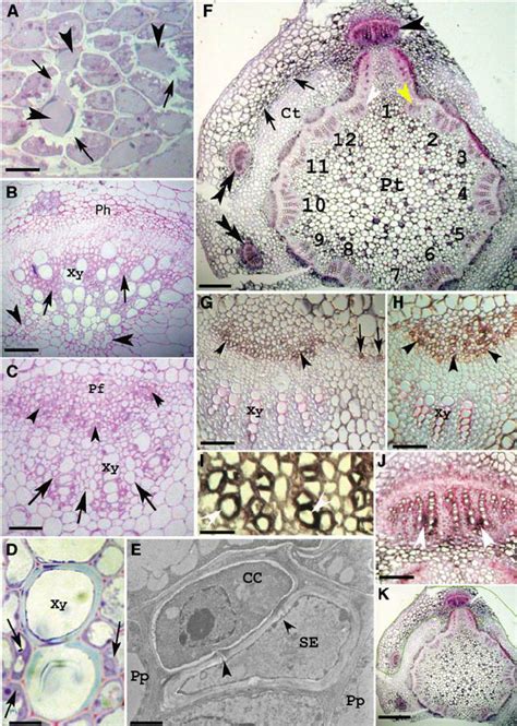 A and B, Stem bundle morphology. C to E, Juvenile bundle morphology. F... | Download Scientific ...