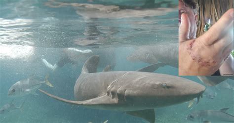 Nurse shark bite in Grand Cayman