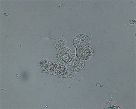 Transitional epithelial cells | eClinpath