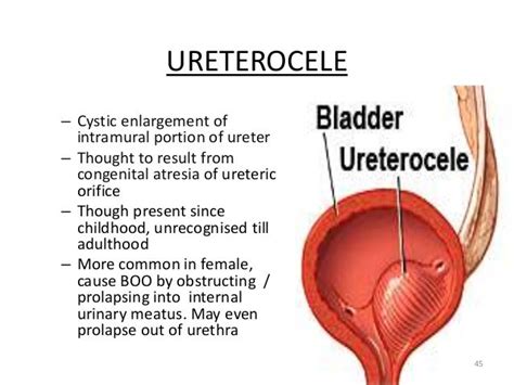 Urinary system embryology