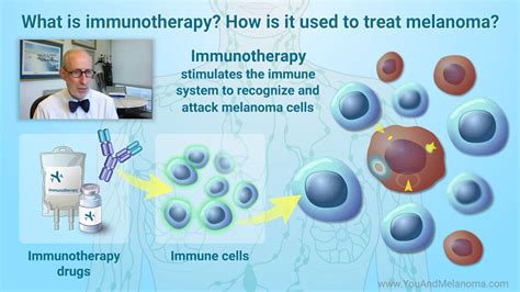 Expert Video - How is melanoma treated with targeted therapy?