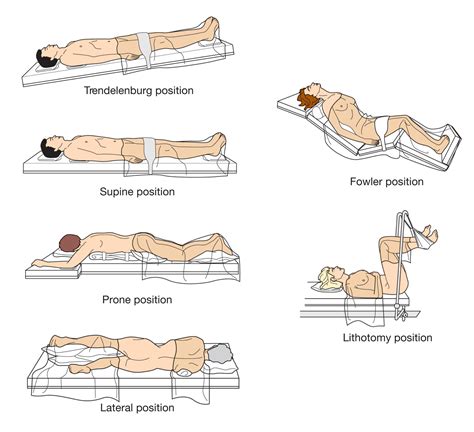 Examples of common surgical positions. - Biology Forums Gallery