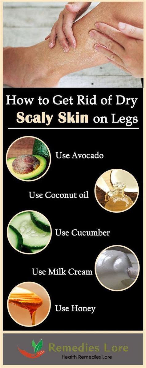 How to Get Rid of Scaly Skin on Legs #ScalySkin http://www.remedieslore ...