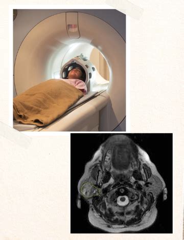 Pituitary Gland Mri Procedure