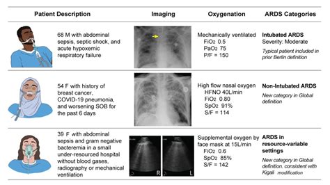 Experts propose new global definition of acute respiratory distress syndrome