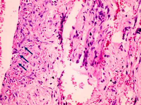 Periosteum Histology