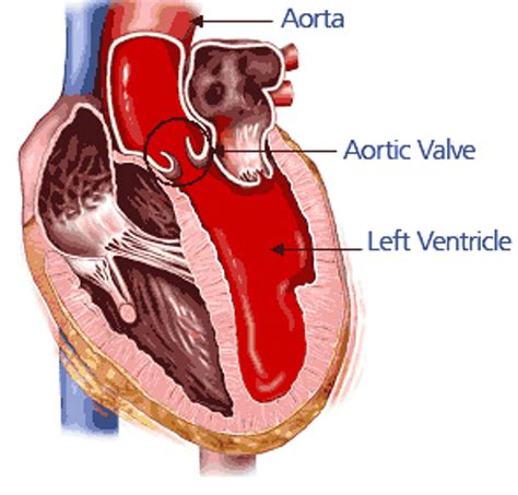 Left Atrioventricular Valve