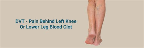 Blood Clot Behind Knee: Causes, Symptoms, and Treatment