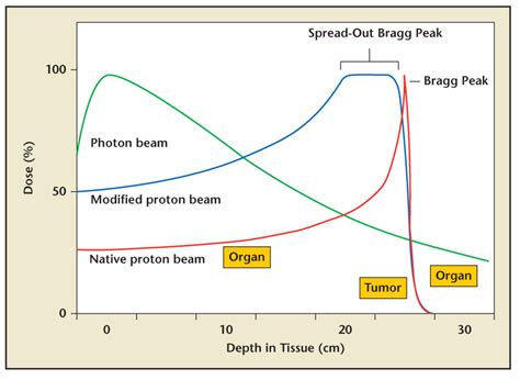 Proton Beam Therapy for Localized Prostate Cancer 101: Basics, Controversies, and Facts