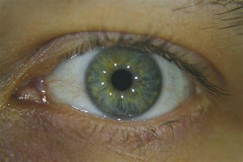 Starry Eyed Surprise | Test shot using home made LED ring li… | Flickr