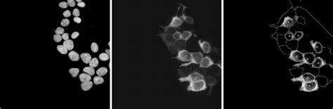 Image of the nucleus-staining of representative cells (a), NIS-specific... | Download Scientific ...