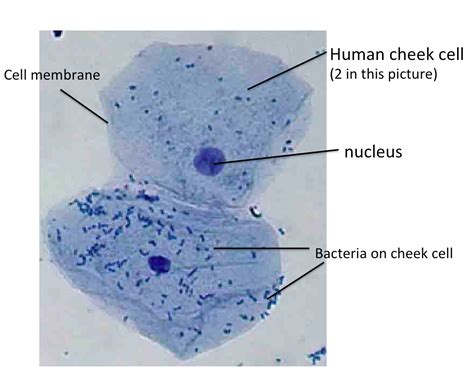 Cheek Cells Under Microscope Labeled