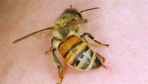 This is how to safely treat a bee sting - New Haven Register