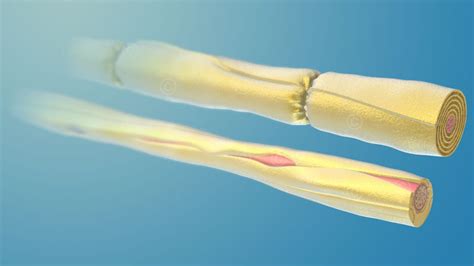 Types of nerve fibers - MedicalGraphics