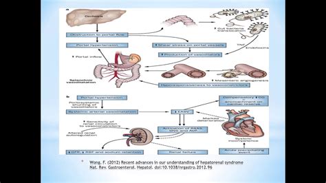 Hepatorenal Syndrome - YouTube