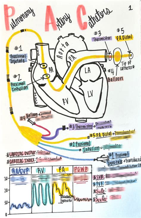 Pulmonary Artery Catheter Waveforms