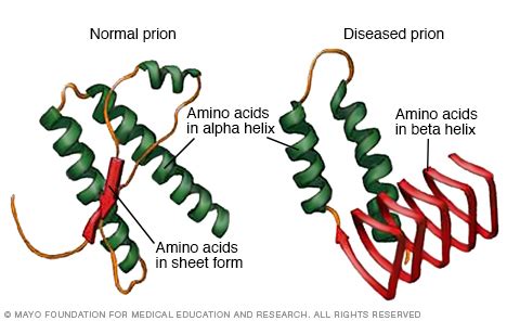 Creutzfeldt-Jakob disease - Symptoms and causes - Mayo Clinic