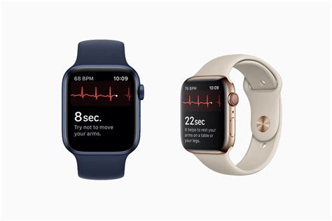 Apple Watch ECG Setup and Use Guide - SimplyMac