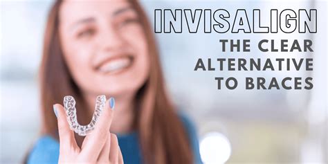 Invisalign Aligners: Treatment, costs, and why you should get them