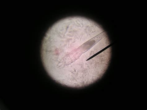 Demodex canis 100x | The same still-living demodex canis mit… | Flickr