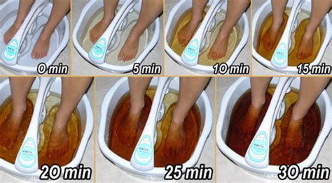 Detox Foot Spa - Ionic Detoxification To Cleanse & Remove Toxins