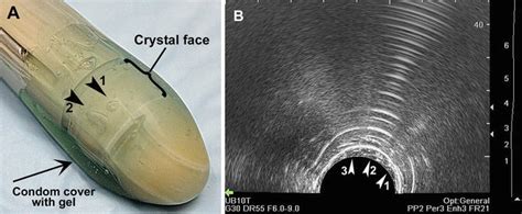 Ultrasound Artifacts and How to Fix Them | Oncohema Key