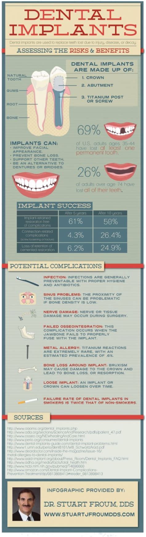 Dental Implants Risk – Find Local Dentist Near Your Area