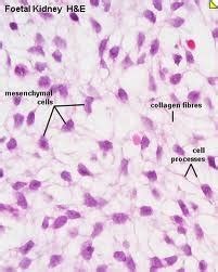 Connective: Mesenchyme Flashcards | Quizlet