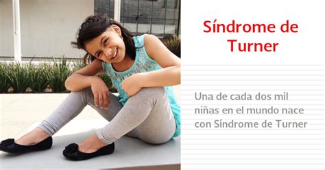 Sindrome de Turner - Vivir mejor