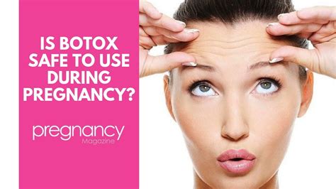 Is botox safe to use during pregnancy? - YouTube