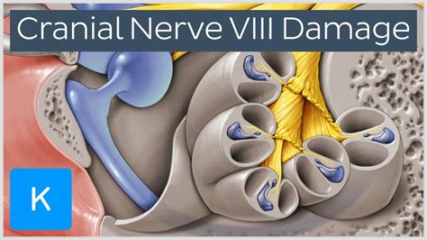 How Do You Know If Your Auditory Nerve Is Damaged? The 11 Top Answers ...