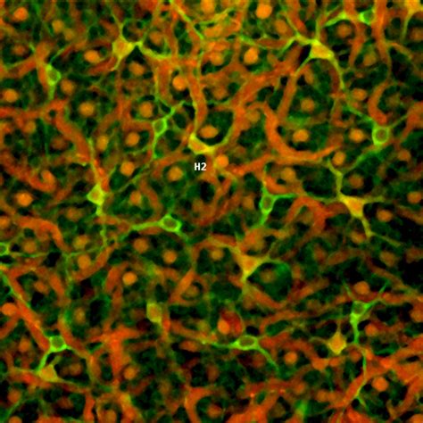 Horizontal cells – Retinal Microscopy