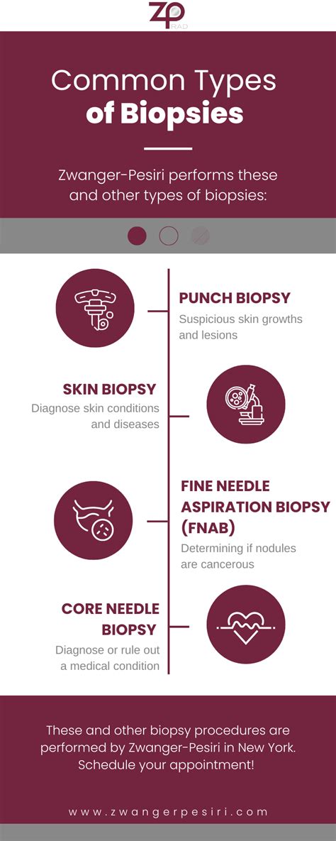 Different Types of Biopsy and When to Get One - Zwanger-Pesiri Radiology