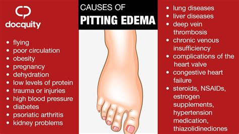 Pitting Edema Symptoms Causes And When To See A Doctor All My Medicine ...