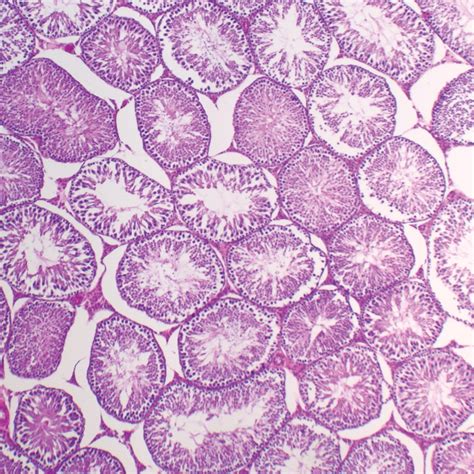 Mammal Testis Prepared Microscope Slide, 7Μm, H & E Stain - Walmart.com