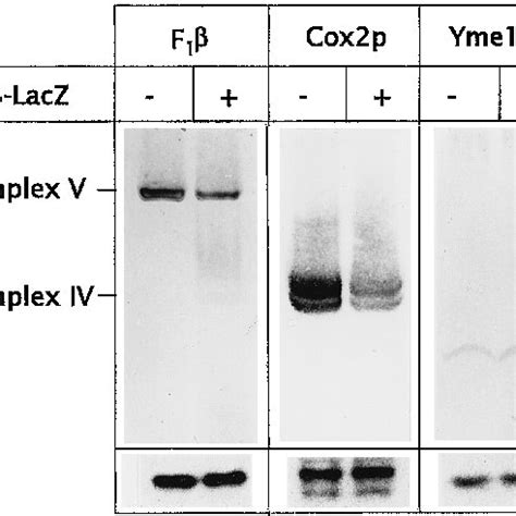 Expression of F 1 -LacZ fusion protein leads to decreased assembly of ...