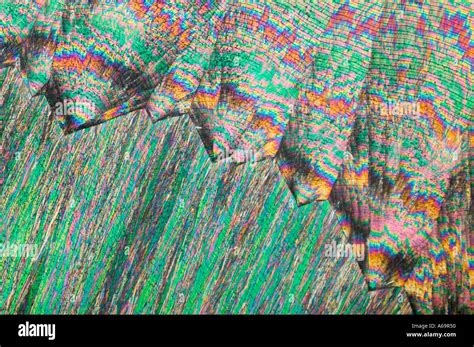 Hippuric acid crystals photomicrograph crossed polarized lighting Stock ...