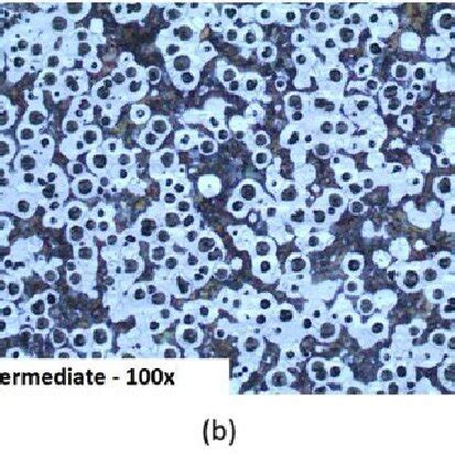 Microstructures of the nodular cast iron with low silicon content; (a ...