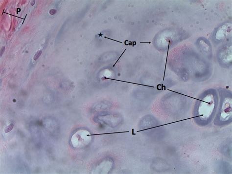 Hyaline Cartilage 400X Labeled