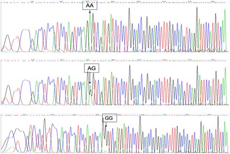 Genotyping results of the gene of VKORC1. AA represents the AA genotype... | Download Scientific ...