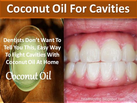 How to Reverse Cavities Naturally and Heal Tooth Decay | Health Treasure