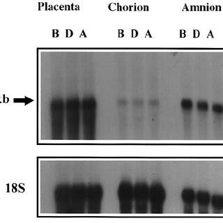 Representative Northern blot hybridization of 30 μ g total RNA from... | Download Scientific Diagram